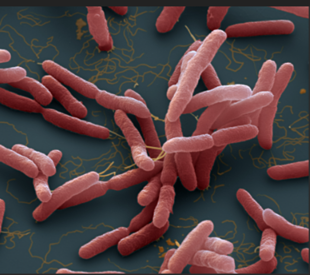 Bacterie die in de grond aanwezig is, doodt 14 mensen na overstromingen in Queensland