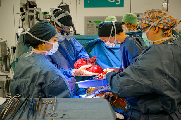 UZ Leuven voerde 1500ste longtransplantatie uit