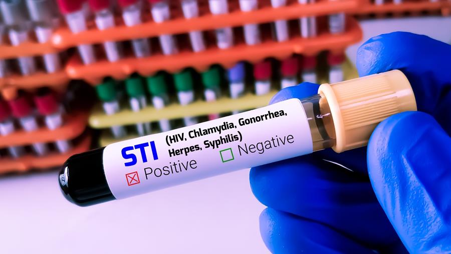 DoxyPEP: ook effectief bij preventie van soa’s in de reële praktijk