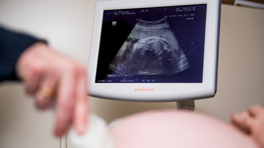 Hoger risico op doodgeboorte door hitte