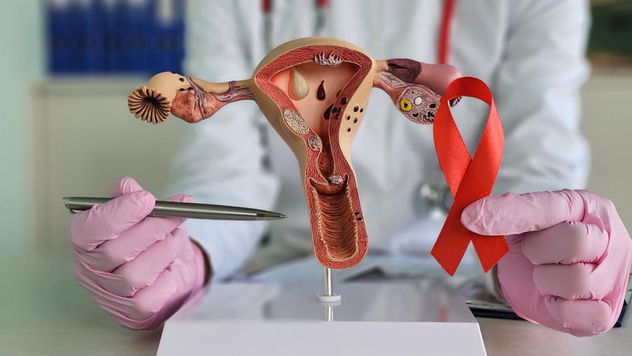 Cancer de l'utérus: les chances de survie varient selon l'hôpital